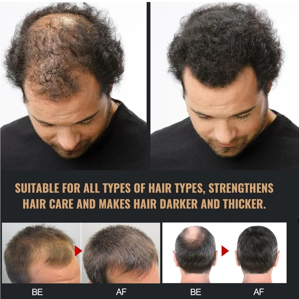 Root Activating Shampoo Set (055) - Picture 4 of 6